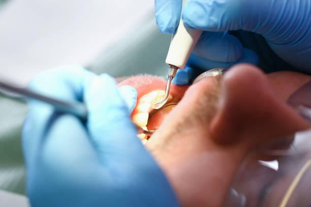 Best Emergency Broken Tooth Repair in Clinton, WI