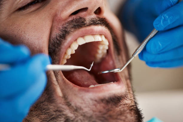 Best Emergency Broken Tooth Repair in Clinton, WI